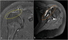 Fig. 29
