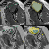 Fig. 32