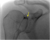 Fig. 26