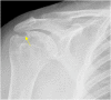Fig. 15