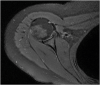 Fig. 25
