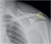Fig. 16