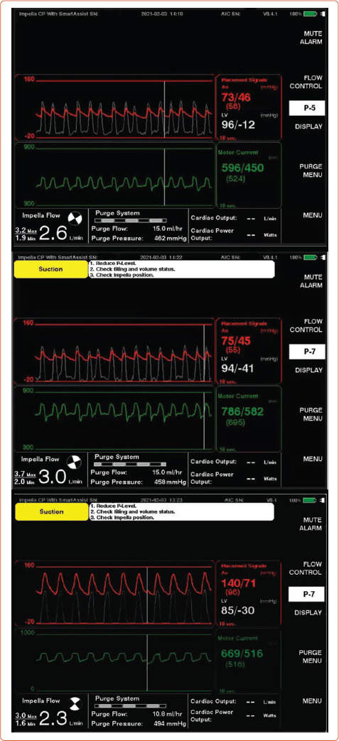 Figure 2: