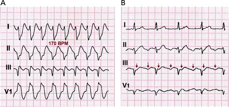 Figure 4: