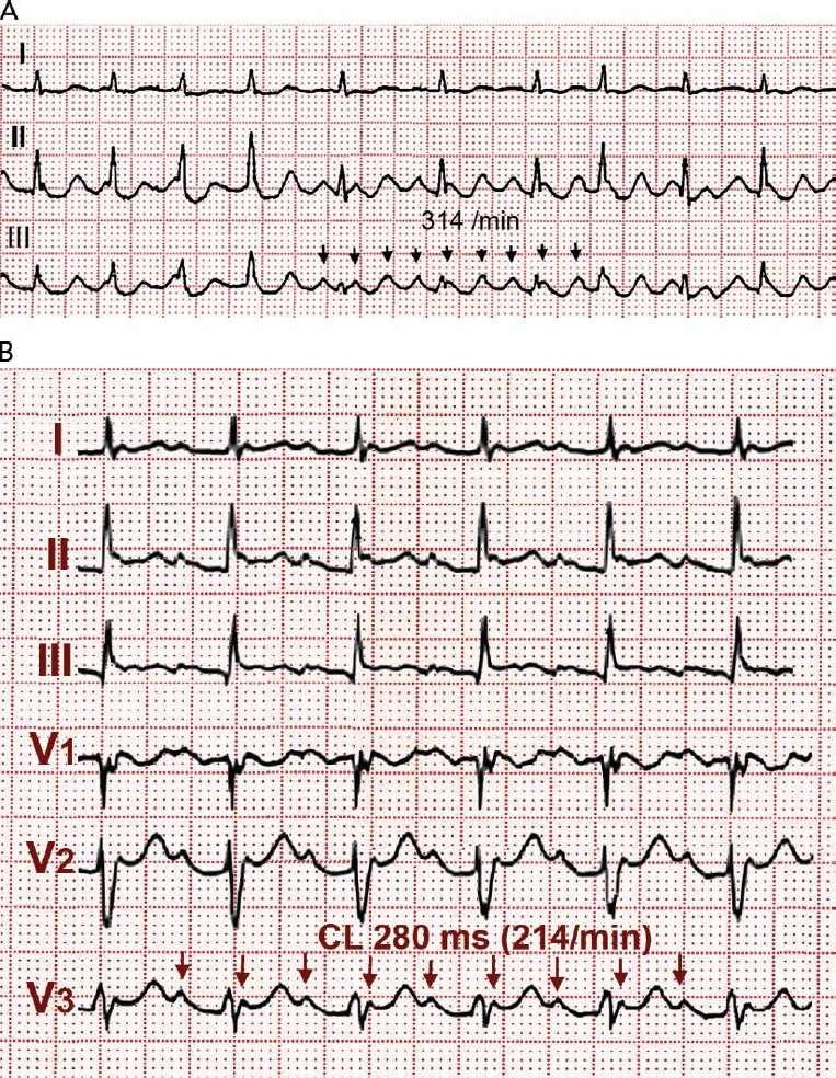 Figure 1: