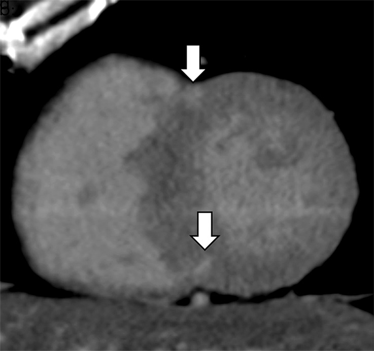 Figure 2a: