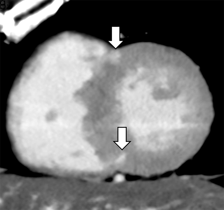 Figure 2b: