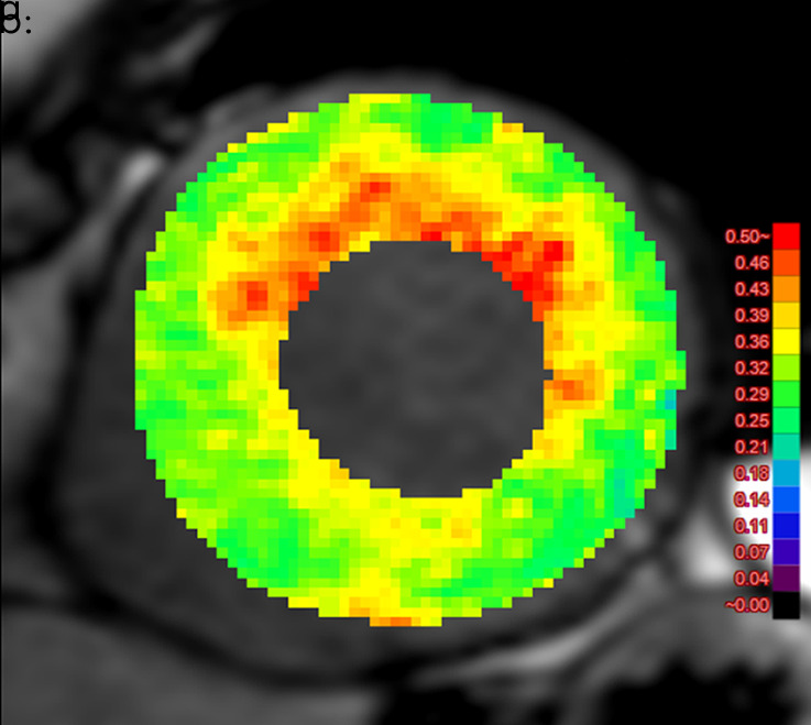 Figure 4b: