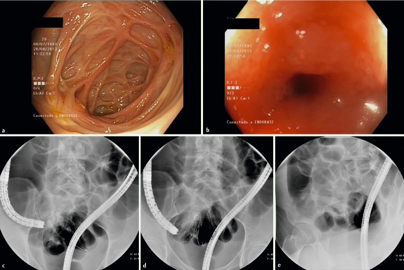 Fig. 2 