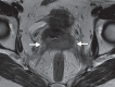 Figure 5a