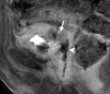 Figure 19b