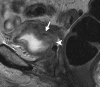 Figure 19a
