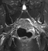 Figure 16a