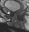 Figure 11b