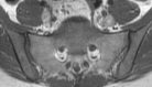 Figure 20a