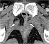 Figure 2e