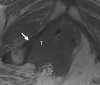 Figure 14a