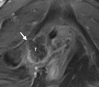 Figure 14b
