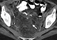 Figure 2c