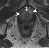 Figure 11a