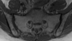 Figure 20b