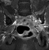 Figure 16b