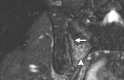 Figure 20d