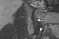 Figure 20c