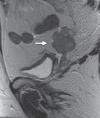 Figure 6a