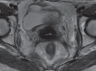 Figure 5c