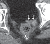 Figure 21a