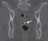 Figure 4b