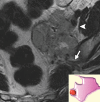 Figure 15b