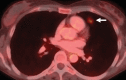 Figure 17b