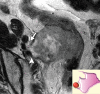 Figure 15a