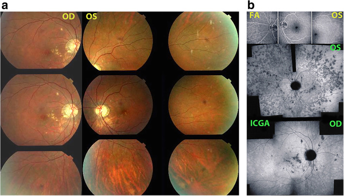 Fig. 3