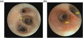 Fig. 3