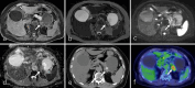 Fig. 3