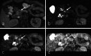 Fig. 12