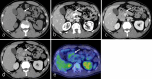 Fig. 14