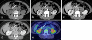 Fig. 13