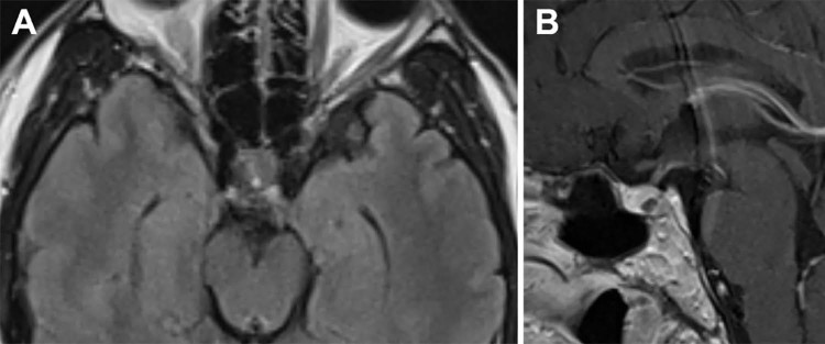 Fig. 2