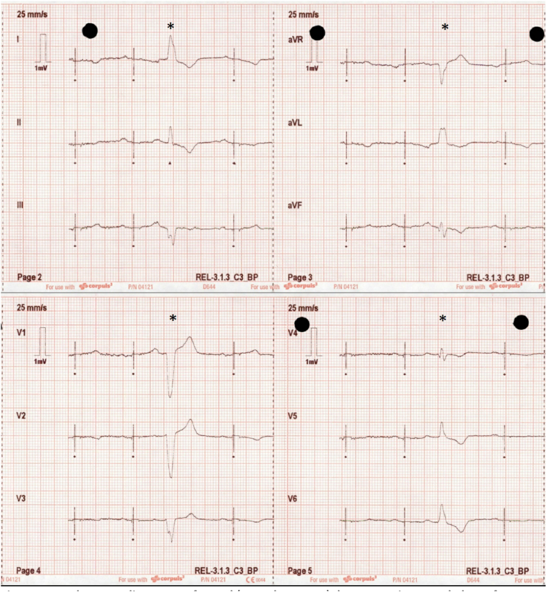 Fig. 1