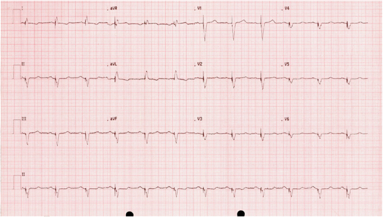 Fig. 2