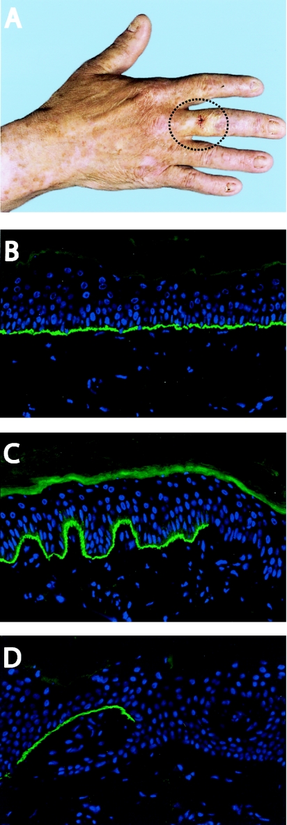 Figure  1