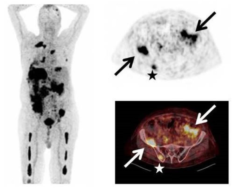 Figure 14