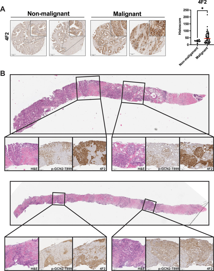 Figure 7—figure supplement 3.