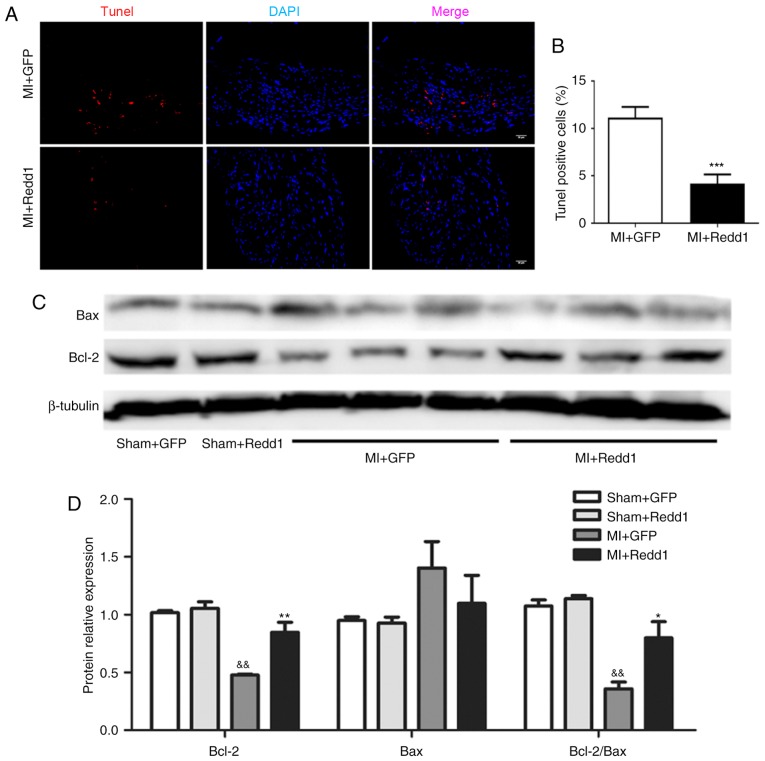 Redd Protects Against Post Infarction Cardiac Dysfunction By Targeting Apoptosis And Autophagy