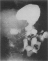 216
