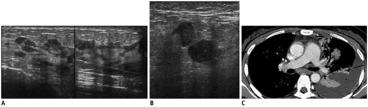 Fig. 11